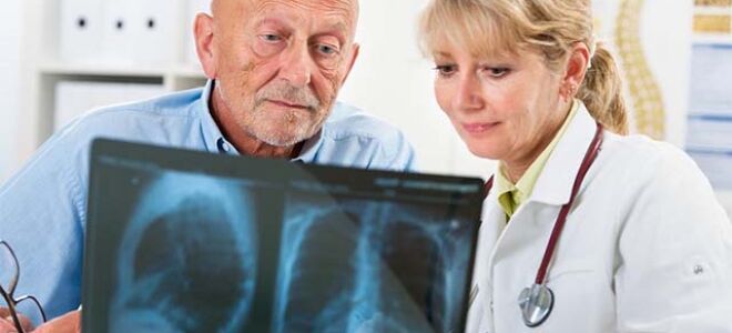 Лечение и прогноз выздоровления застойной пневмонии у пожилых людей