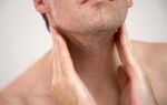Что делать, если воспалился лимфоузел на шее: причины, клинические проявления, методы лечения, профилактика