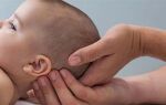 Причины и последствия возникновения у новорожденных детей водянки головного мозга