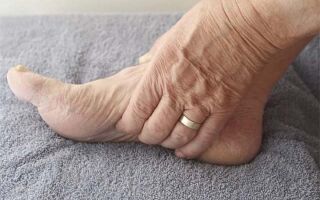 Причины и лечение сильного отека ног внизу стопы и голени у пожилых людей