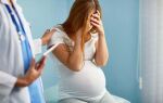 Как избавиться от отеков при беременности на поздних сроках и чем они опасны