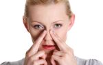 Отекает слизистая носа: симптомы, причины и лечение