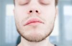 Причины и методы лечения аллергического отека губ