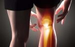 Причины отека коленного сустава и эффективное лечение