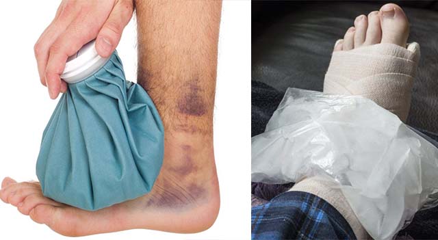 Отеки на ступнях ног домашнее лечение thumbnail