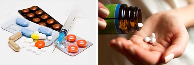 Медикаментозное лечение таблетками и уколами