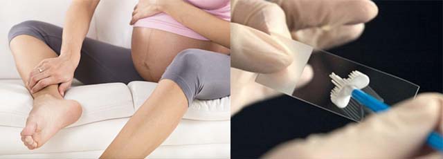 Отечность ног у женщин лечение thumbnail