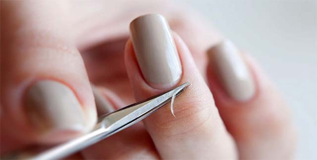 Что делать если опух палец возле ногтя на руке thumbnail