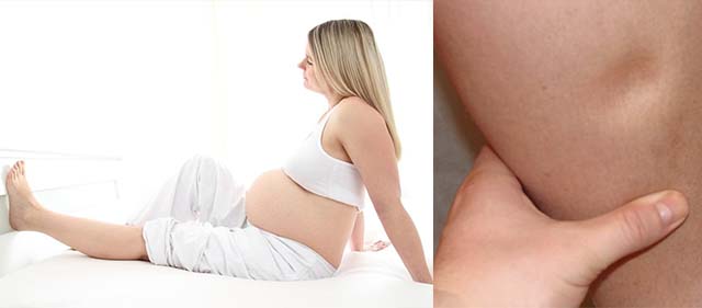 Чем опасны отеки при беременности в 3 триместре thumbnail