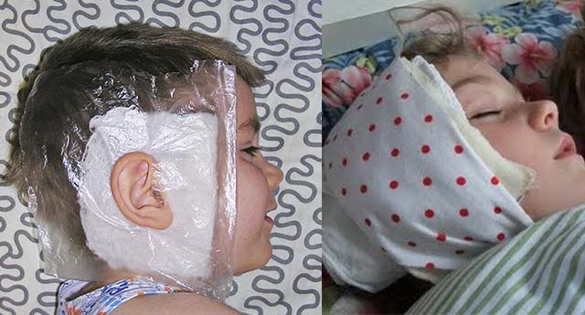 Воспаление лимфоузлов на шее у ребенка лечение в домашних условиях быстро thumbnail