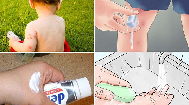 У детей отеки от укусов комаров у ребенка thumbnail