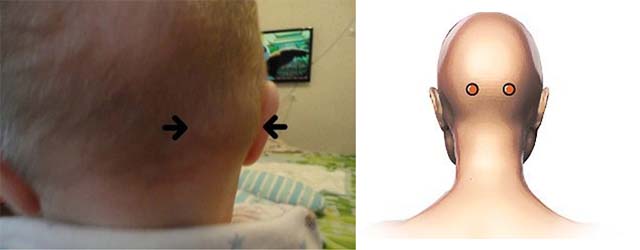 Где находятся лимфоузлы на шее у ребенка фото