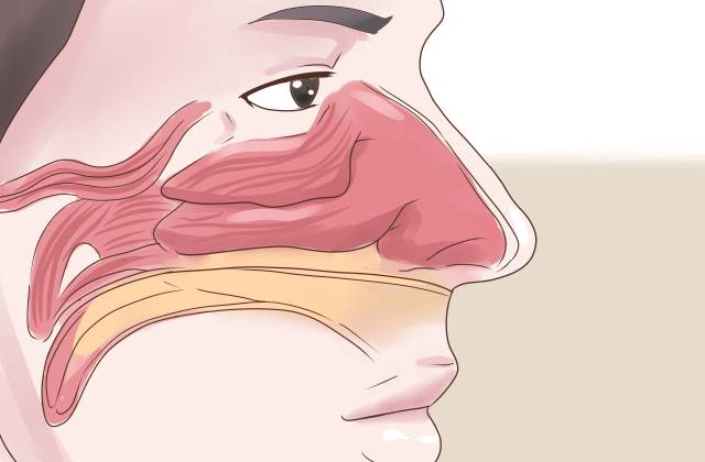 Отек тканей носа