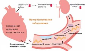 Асцит карта смп