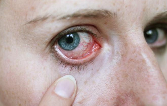 Лечение отека роговицы глаза после операции thumbnail