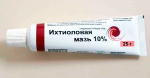 Мазь от отеков на ногах: 11 противоотечных препаратов для ног